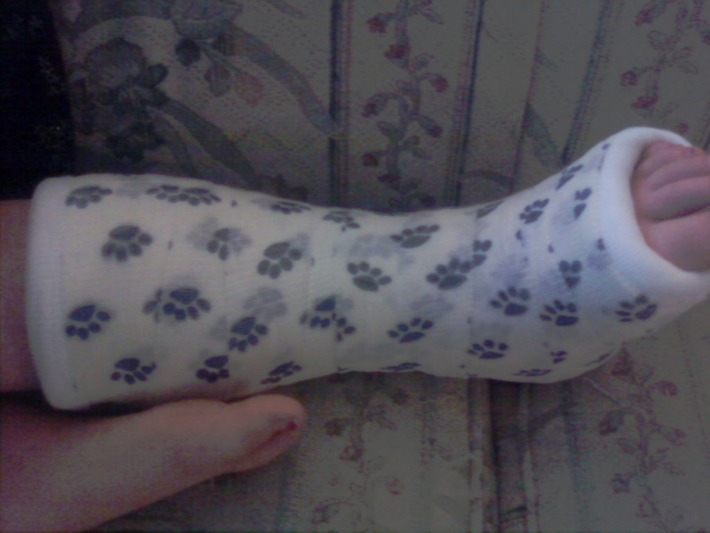 Broken leg.