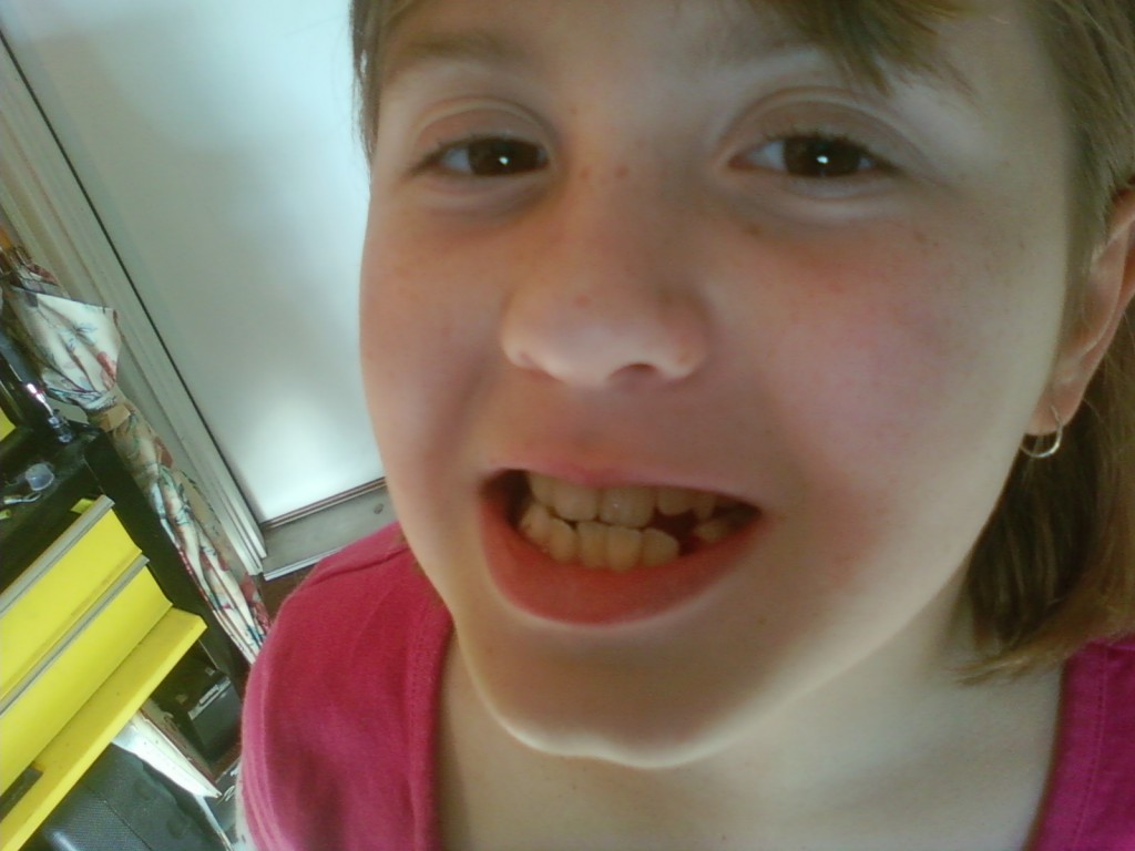 Jamie lost a tooth.